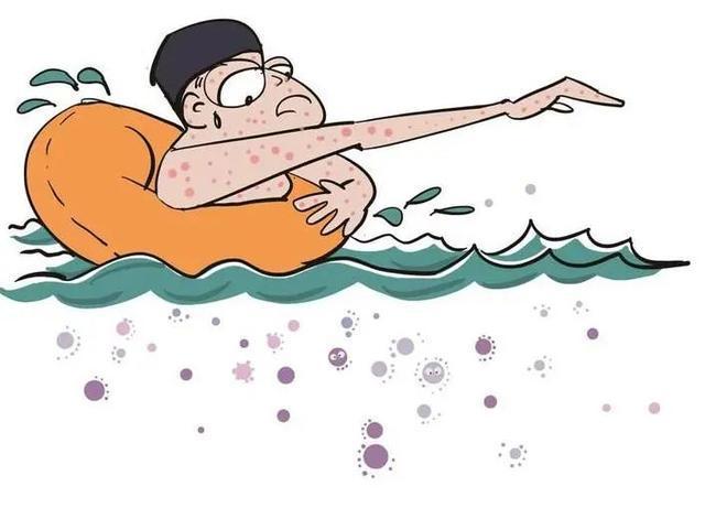 1776060949670254.jpeg 游泳池細菌2.jpeg